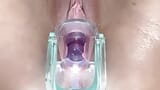 Cervix Throbbing and Flowing Oozing Cum During Close Up Speculum Play snapshot 15