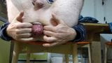 MY PROLAPSE snapshot 6