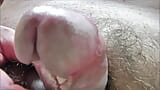 Cbt peilende urethra en blaas met 3 dilatatoren in close-up snapshot 14