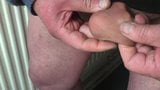 Foreskin with 3 dice and a table tennis ball snapshot 6