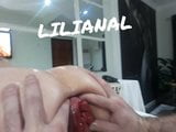 Prolapso anal snapshot 5