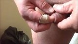 Foreskin with ice - 3 videos snapshot 1