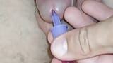 insertion of the pointed reamer into the dick channel. snapshot 14