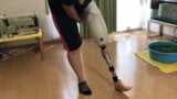 Japanese SAK amputee girl hopping & wearing prosthesis snapshot 5