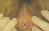 Gynecological examination snapshot 7