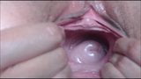 Nena gape coño y cervix jugar snapshot 20