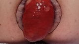 More prolapse snapshot 6