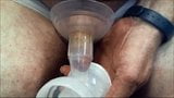 Göğüs pompası kullanarak sünnet derisi çörek snapshot 11