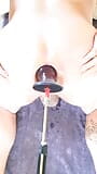 Plug anal snapshot 6