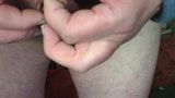 Foreskin with 3 dice and a plastic lid snapshot 6