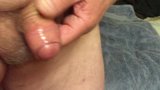 Foreskin with ice - part 2 snapshot 3