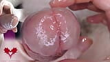 Super close-up van de eikel. urethrale spelletjes met de dilatator. snapshot 4