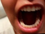 Throat, tongue and roof of mouth snapshot 6