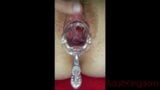 Pussy gets fisted and opened with a speculum snapshot 7