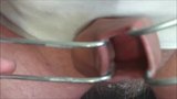 Creamy foreskin 20 minute video snapshot 16