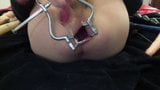 Anal Speculum 3 snapshot 17