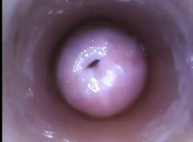 질 자궁과 질내 사정307 | xHamster
