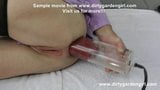 Deep dildo insertion and enormous prolapse fun snapshot 5