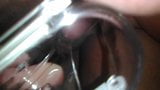 foreskin stretch speculum snapshot 2