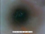 Inside my peehole snapshot 1