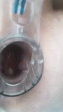 Speculum inside snapshot 5