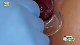 Daphne Klyde made to squirt twice in gyno chair snapshot 11