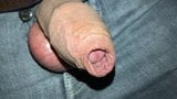 foreskin close up super snapshot 5