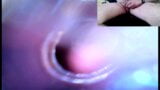Trip down the urethra with two cameras snapshot 3