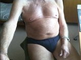 78 yo man from Switzerland - 2 snapshot 11