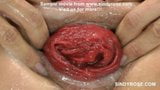 Hot blonde anal & fisting prolapse extreme snapshot 10