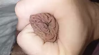 Ginekolog tomonidan tekshirilayotgan qizlarning fotosuratlari