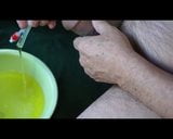 Urine out of the catheter 2 snapshot 9