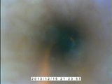 Inside my peehole snapshot 7