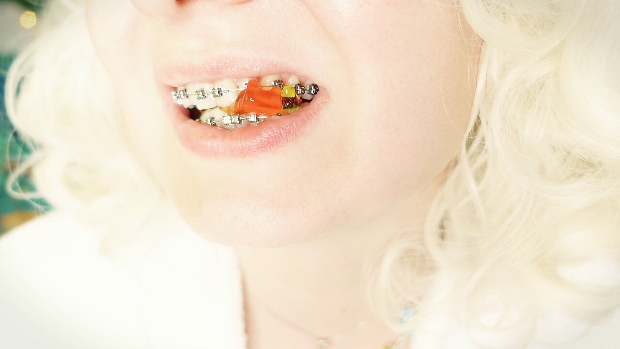 BRACES fetish: ASMR video of eating MUKBANG…