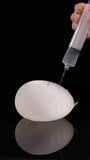 Filling breast implants snapshot 15