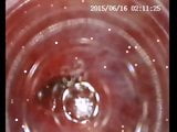 Inspect Urethra Using Plastic Hose snapshot 7