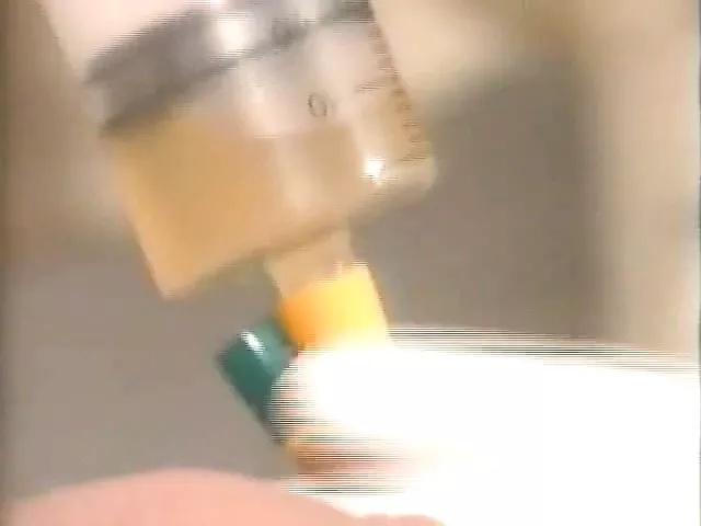 Bizarre German Vintage Rubber Gyno Session: Doctor Porn | xHamster