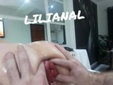 Prolapso anal snapshot 1