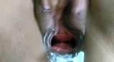 speculum spread vagina snapshot 5