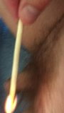 Burning Pubic Hair snapshot 2