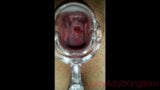 Pussy gets fisted and opened with a speculum snapshot 6