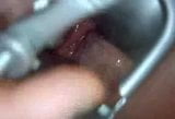 TDD11-Deep Speculum and Anal Gape snapshot 12