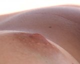 Nipple snapshot 2