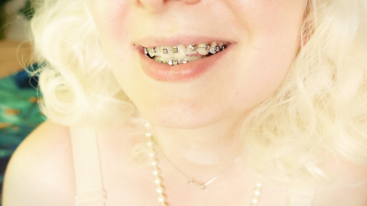 BRACES fetish: ASMR video of eating MUKBANG……