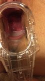 Wife speculum in pussy cervix 1 snapshot 1