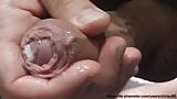 Mein Penis - Vorhaut, Foreskin, Cum, Closeup 5 snapshot 14