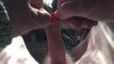 Foreskin in sun with: table tennis ball snapshot 1