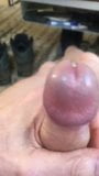 Foreskin rolled back snapshot 1