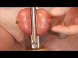 Premature sperm tapping snapshot 1