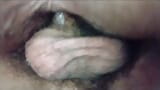 The doctor stimulates my urethra with his instruments and in the end I receive his cock in my hairy pussy snapshot 19